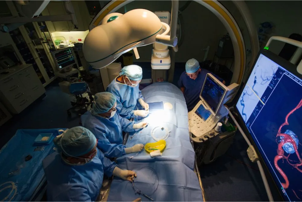 Aneurysm Coiling Procedure How It Works